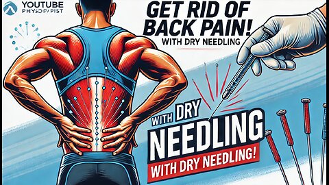 Get Rid of Back Pain with Dry Needling!
