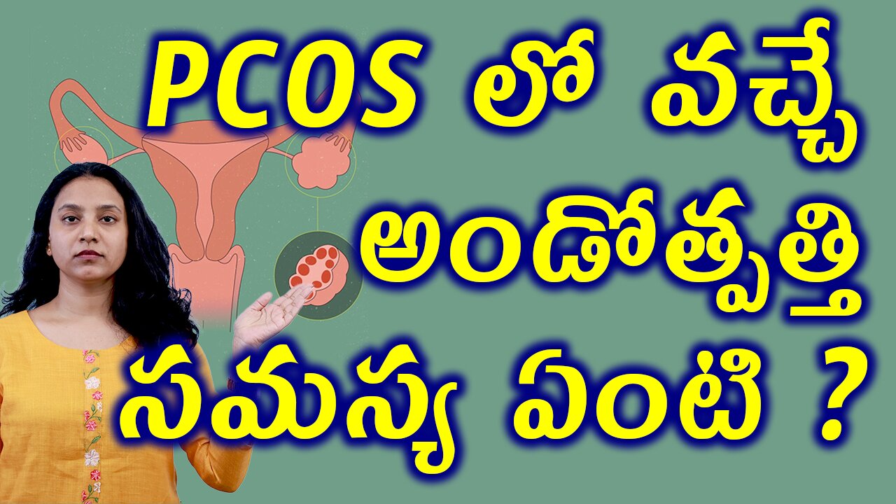 PCOS లో వచ్చే అండోత్పత్తి సమస్య ఏంటి? Ovulation Problems in PCOS Best Homeopathy Medicine Treatment