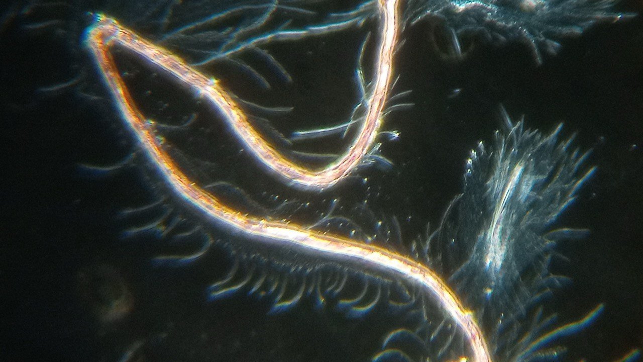 MOUNTAIN MAN'S BLOOD WAR