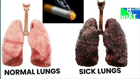Signs your lungs would be in trouble /Health next explained