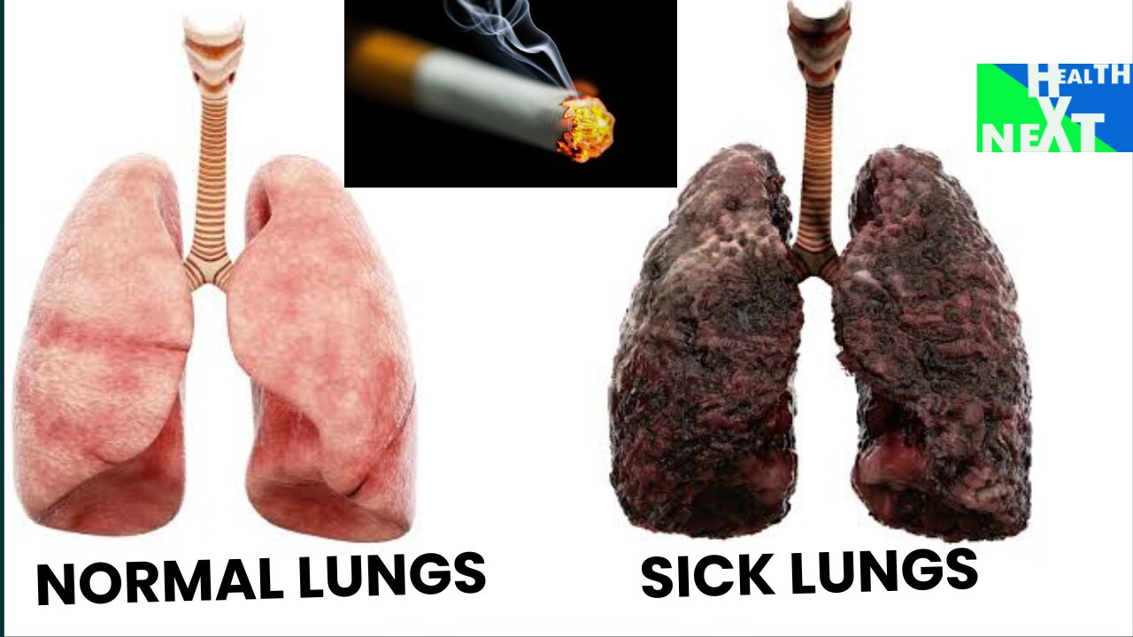 Signs your lungs would be in trouble /Health next explained