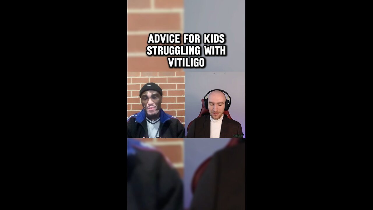 “For those kids who might have vitiligo, who are struggling. What would your advice be to them?”