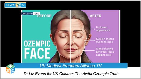 Dr Liz Evans for UK Column: The Awful Ozempic Truth