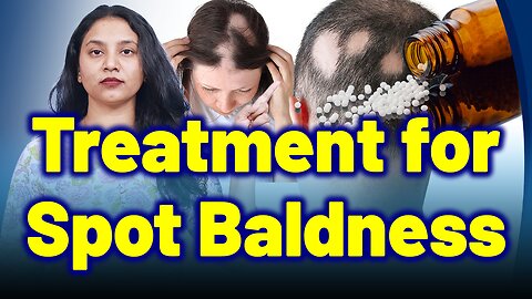 Best Treatment for Alopecia Areata, Patchy Baldness| Treatment Cure | Skin Hair | Homeopathy