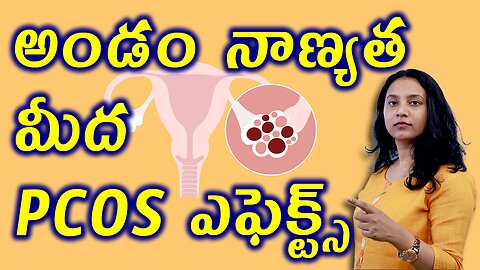 అండం నాణ్యత మీద PCOS ఎఫెక్ట్ Women Ovam Effected by PCOS Causes Treatment Cure Homeopathy Clinic