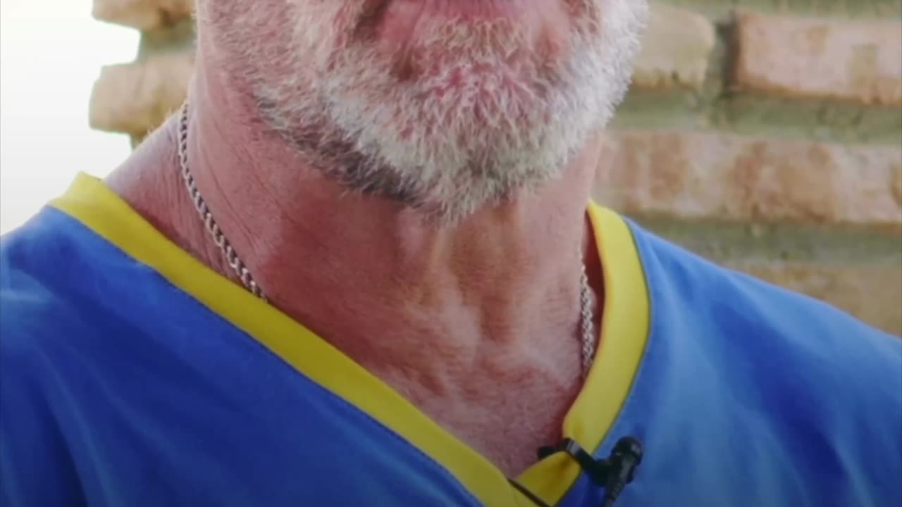 Why I’ll Never Use HCG on TRT Again