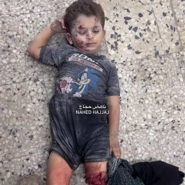 Children injured in Al-Shifa Hospital after a tent sheltering displaced people was targeted
