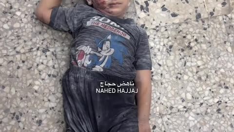Children injured in Al-Shifa Hospital after a tent sheltering displaced people was targeted