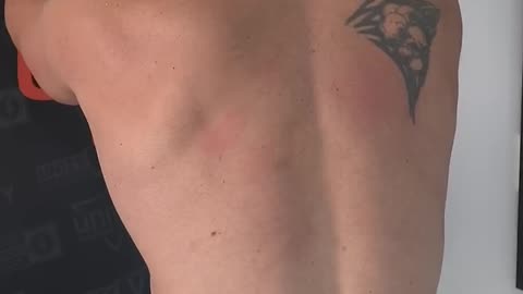 How to Fix Fix Scapular Winging Back