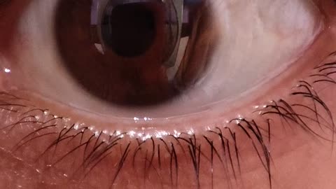 🤯👁️ I Can Rotate My Eyes Independently! Is This Normal? | FeedMyCuriosity