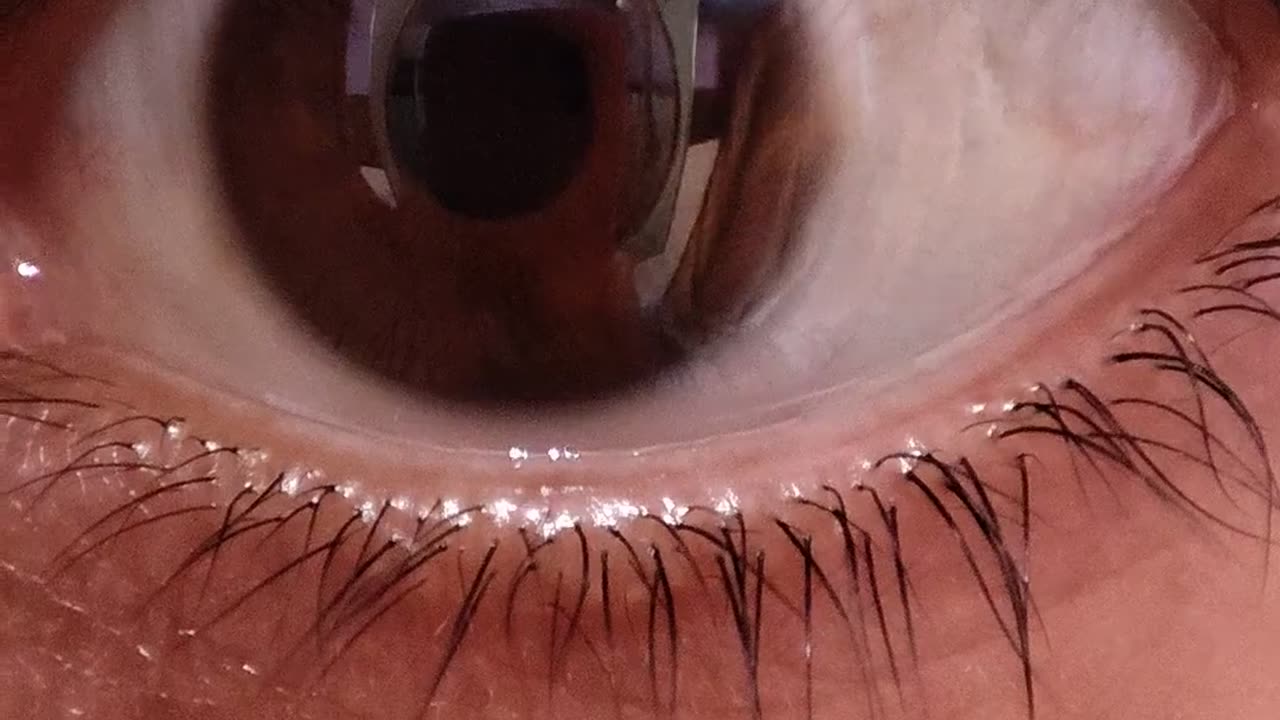 🤯👁️ I Can Rotate My Eyes Independently! Is This Normal? | FeedMyCuriosity