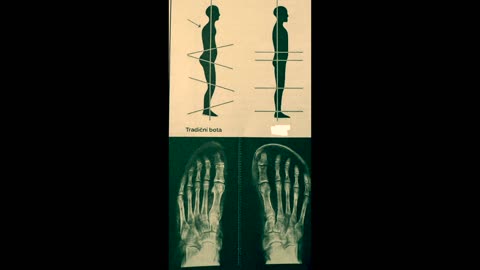 Tradiční obuv Vám ničí nohy