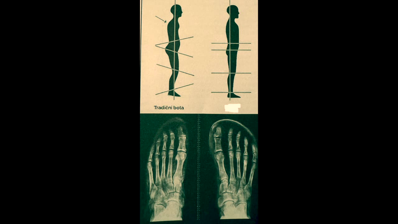 Tradiční obuv Vám ničí nohy