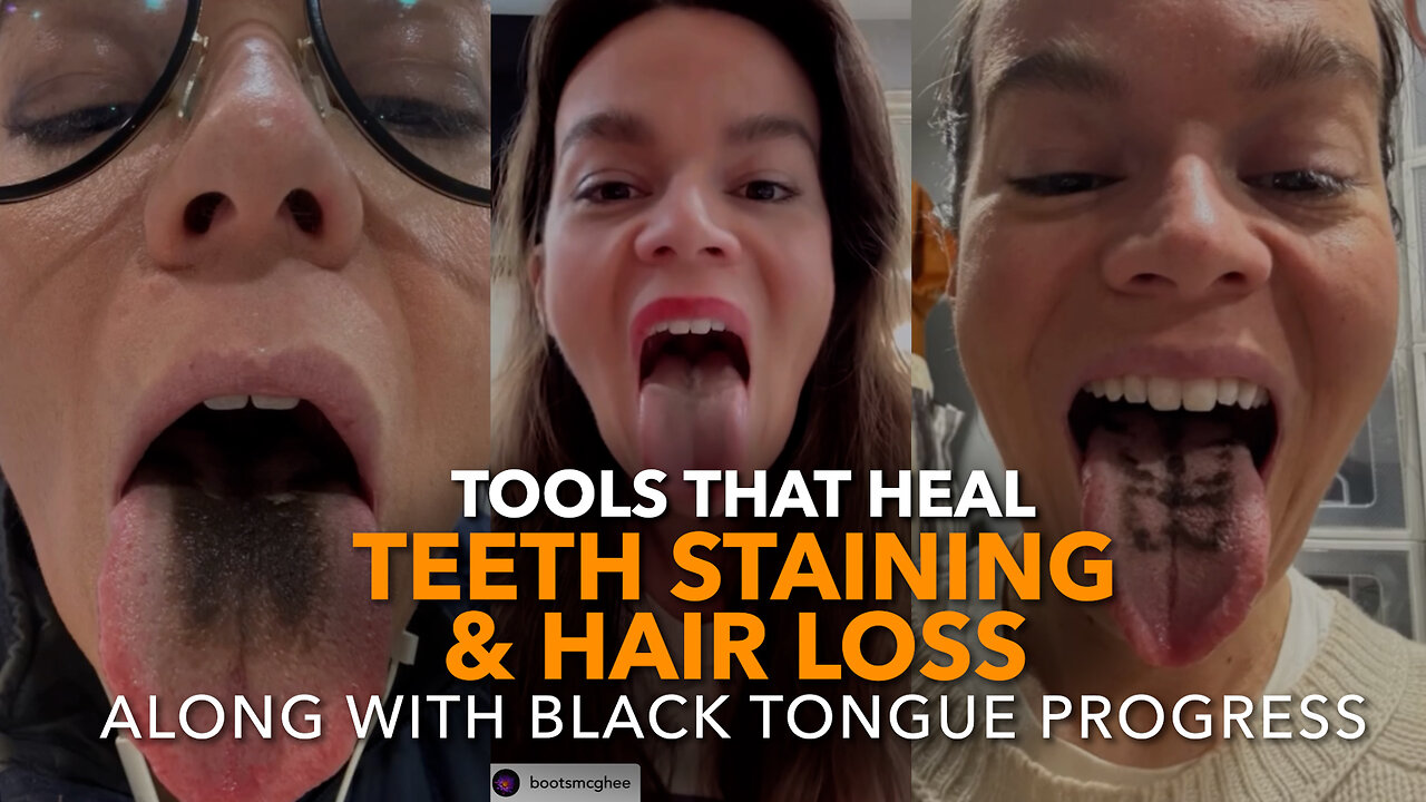 Tools That Heal Teeth Staining & Hair Loss—Along with Black Tongue Progress