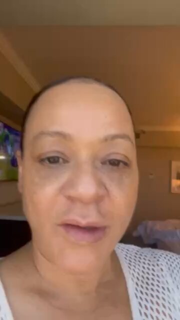 Showing my face so far after full face dissolver diy