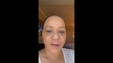 Showing my face so far after full face dissolver diy