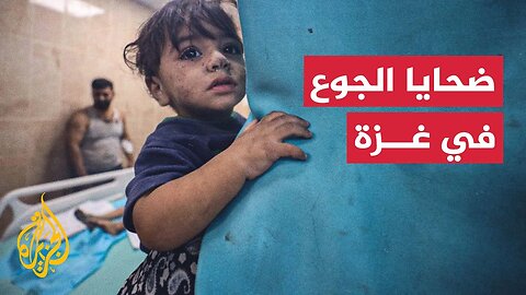 الجوع في غزة__ أعداد ضحايا مراكز توزيع المساعدات
