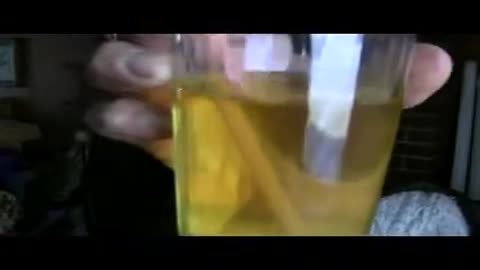 ~ URINE THERAPY FOR ADDICTIONS ~