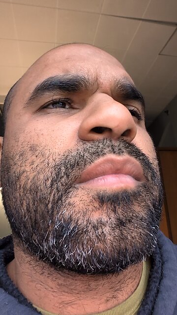 melatonin much stronger