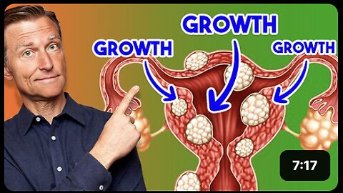 Over 50% of Women Have THIS?!