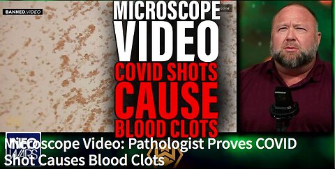 "Pathologist Demonstrates COVID Shot Inducing Blood Clots via Microscope Video"
