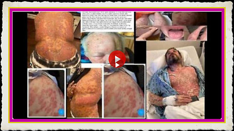 Alarming Experimental Covid Vaccines now proving to be extremely toxic to humans