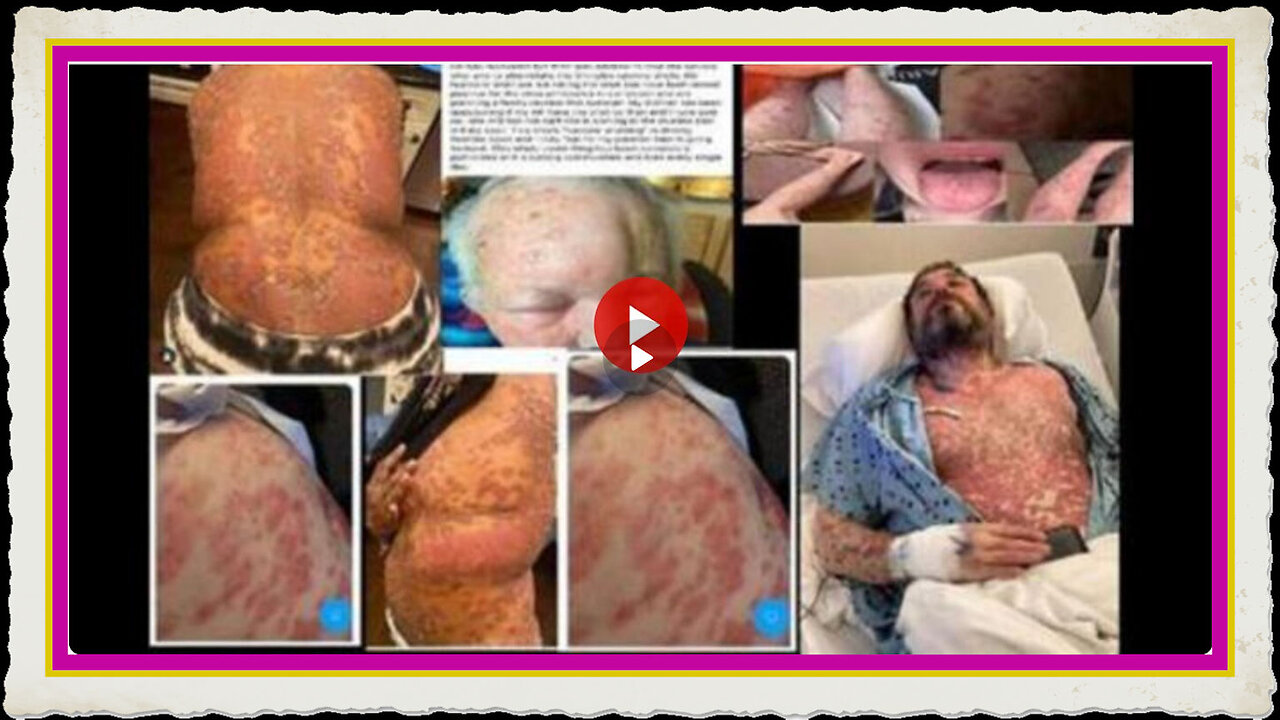 Alarming Experimental Covid Vaccines now proving to be extremely toxic to humans