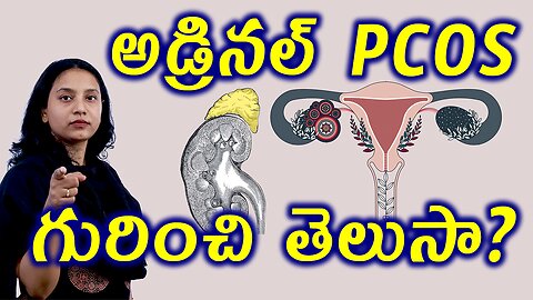 అడ్రినల్ PCOS గురించి తెలుసా? What is Adrenal PCOS? Best and Trusted Homeopathy Treatment Cure