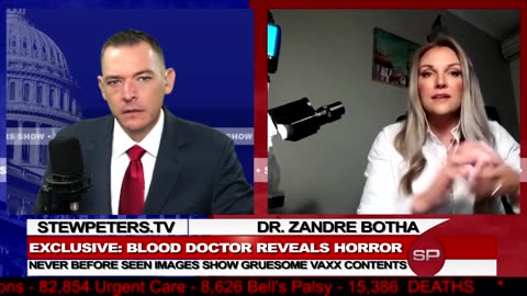 never-before-seen-blood-doctor-reveals-horrific-findings-after-examining-vials