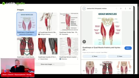 WHAT IS A quadriceps Strain? Caitlin Clark injury explanation, breaking down the facts