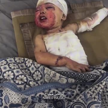 The child Abdullah Al-Hour, 3 years old, is the sole survivor of his family