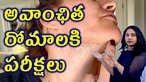 PCOSలో అవాంఛిత రోమాలుకి చేయవలసిన పరీక్షలు ఏమిటి? Tests for Hirsutism Female Unwanted Hair in PCOS