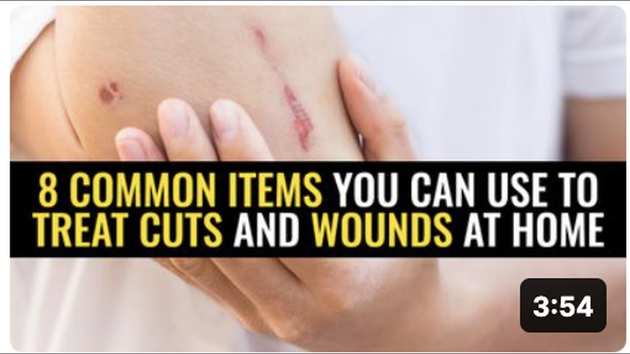 "Home Treatment for Cuts and Wounds Using 8 Common Items"