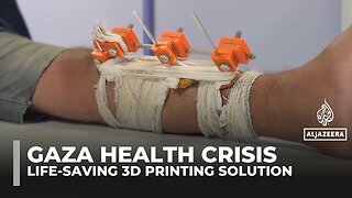 Gaza doctors use solar‑powered 3D printing to save limbs and lives
