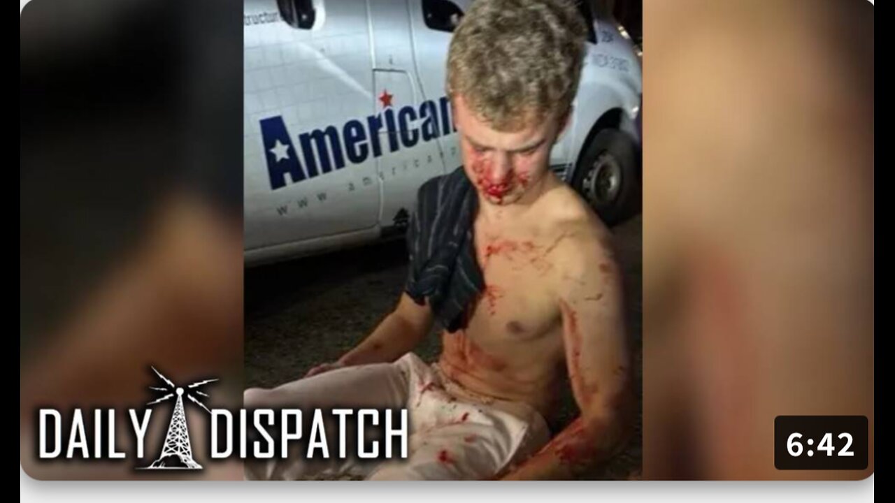 Ex-DOGE staffer 'Big Balls' Left Severely Injured After DC Robbery Attempt