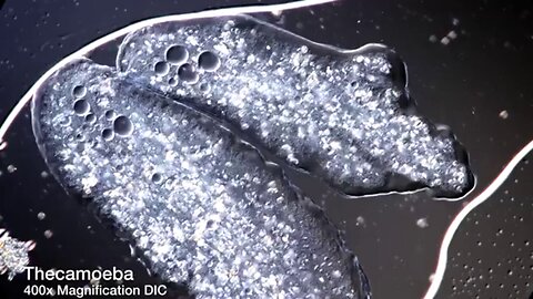 The Amoeba Parasite Similar to the Synthetic (Amoeba) Parasites found in Vaccins