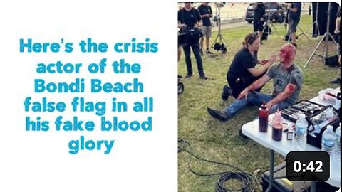 Here’s the crisis actor of the Bondi Beach false flag in all his fake blood glory.