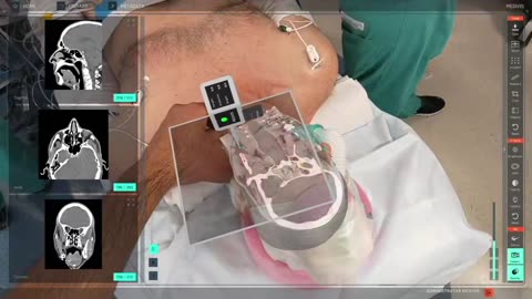 New York surgeons have unveiled an augmented reality device that assists them in their work