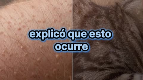 ¿Qué provoca que se nos erice la piel?