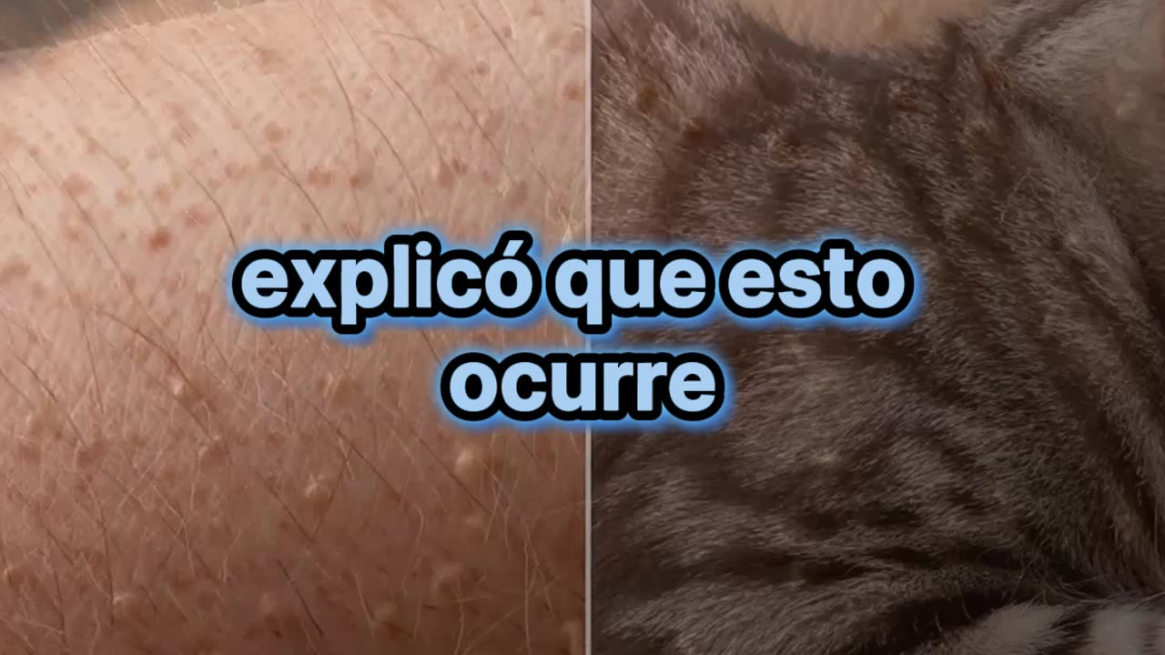 ¿Qué provoca que se nos erice la piel?