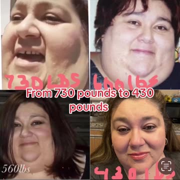 An amazing loss transformation from 730 lbs to 430 lbs