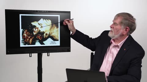 Doug Horne maps Skull Fragments onto Rear Exit Wound vs Larger Postmortem Surgery,Witness Statements