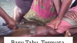 High IQ Hindu Aryan Homeopathic Chiropractic Remedy for Broken Bones