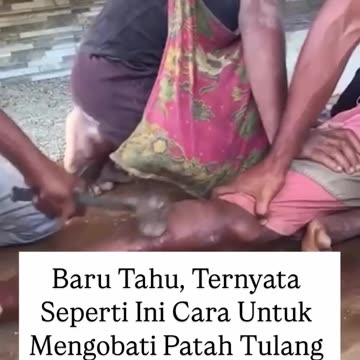 High IQ Hindu Aryan Homeopathic Chiropractic Remedy for Broken Bones