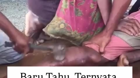 High IQ Hindu Aryan Homeopathic Chiropractic Remedy for Broken Bones