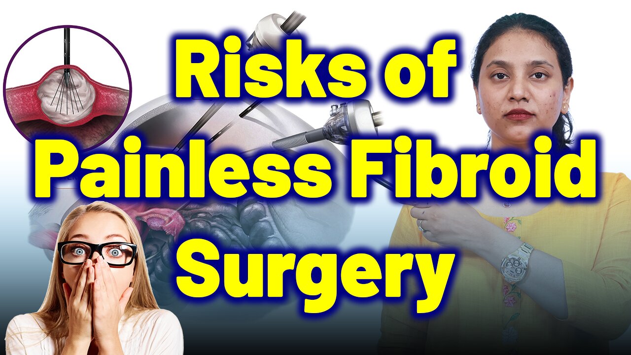 Painless Fibroid Surgery – The Hidden Dangers You Must Know | Treatment Cure Medicine | Gynaecology