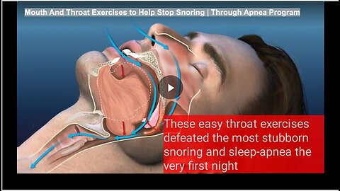 "Apnea Program's Mouth and Throat Exercises to Combat Snoring"