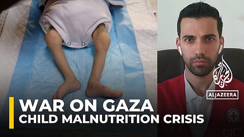 Acute malnutrition impacting everyone in Gaza especially children ICRC
