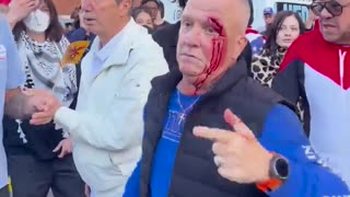 No King protestors stole grandpa's glasses for voicing differing opinion