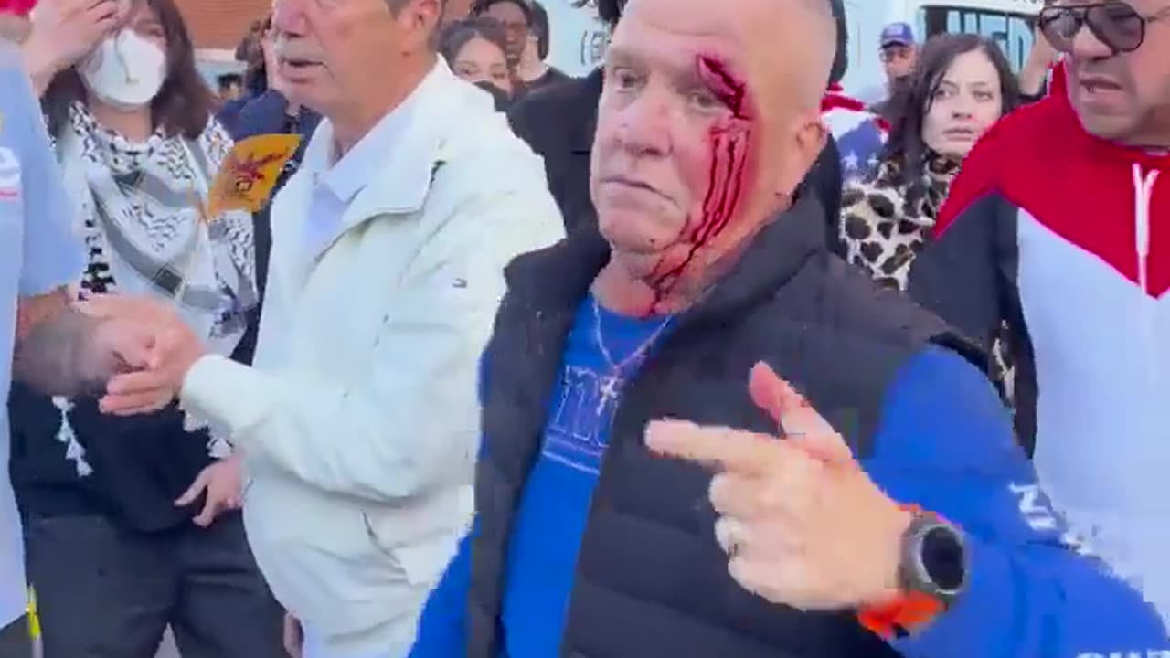 No King protestors stole grandpa's glasses for voicing differing opinion